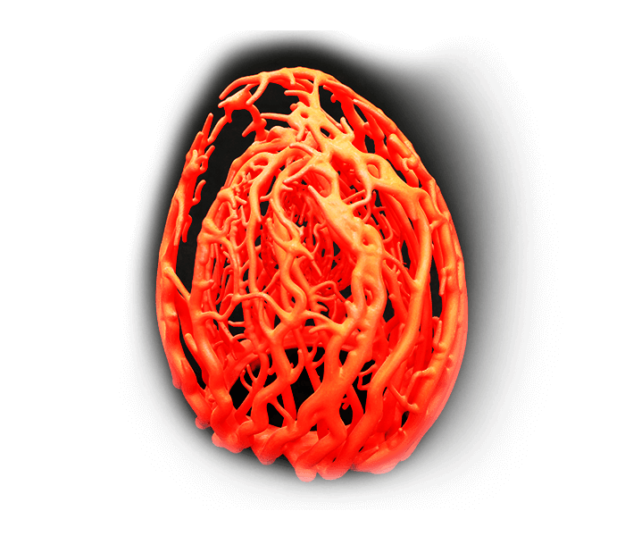 Stereolithography (SLA)